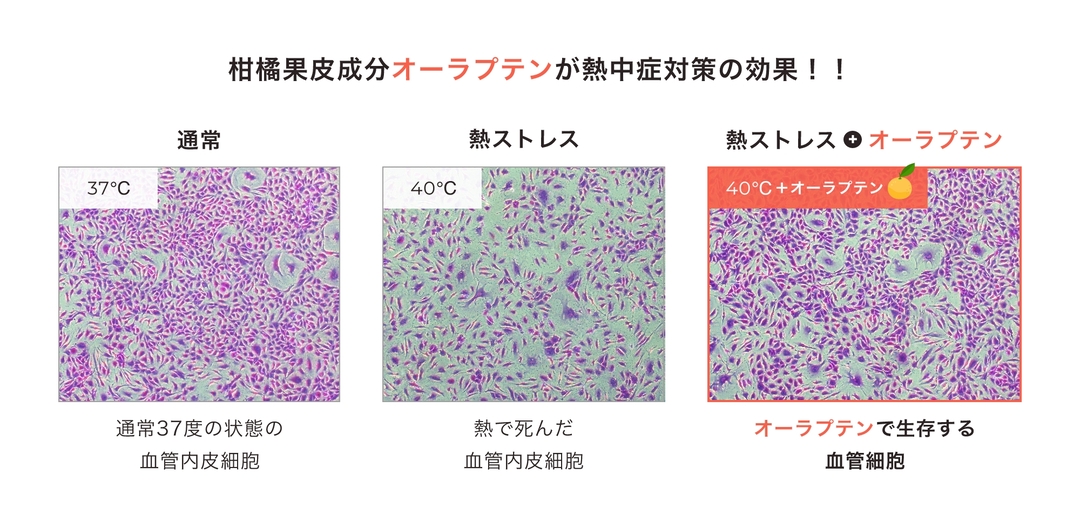 No.03_BloodVessels